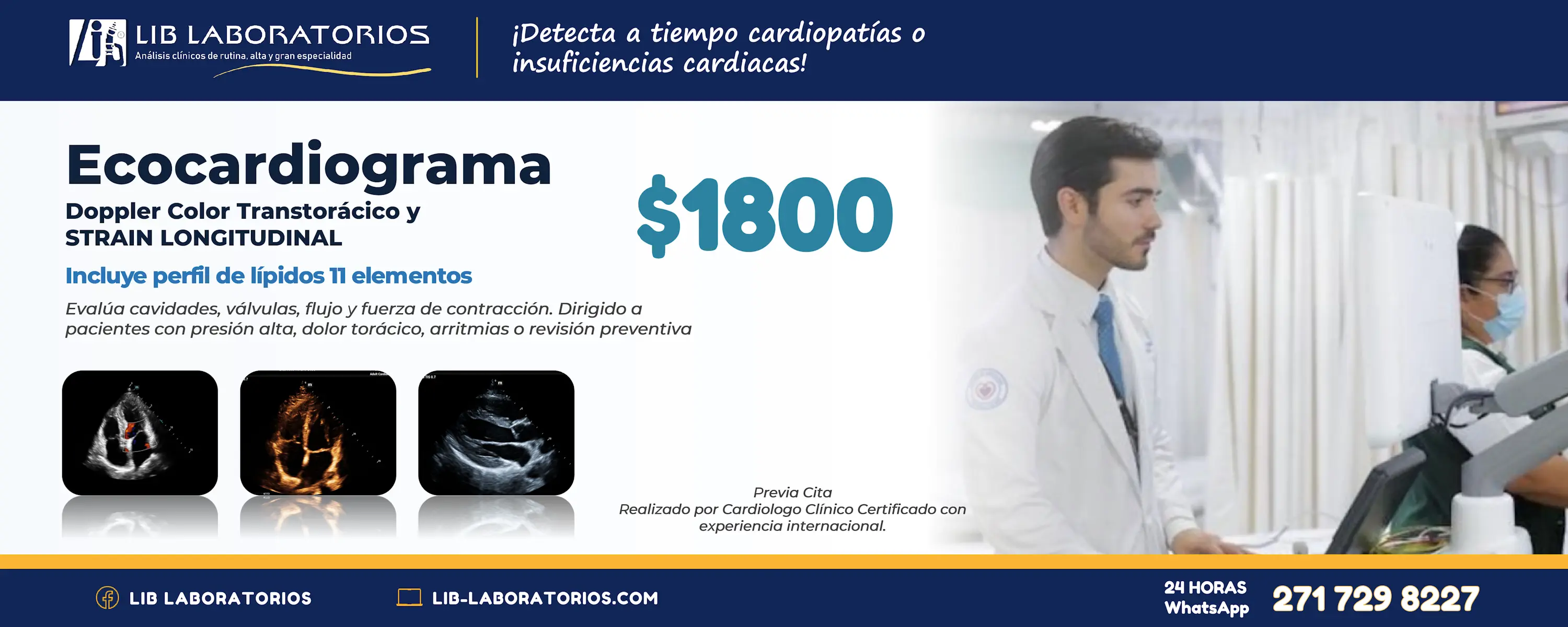 Ecocardiograma